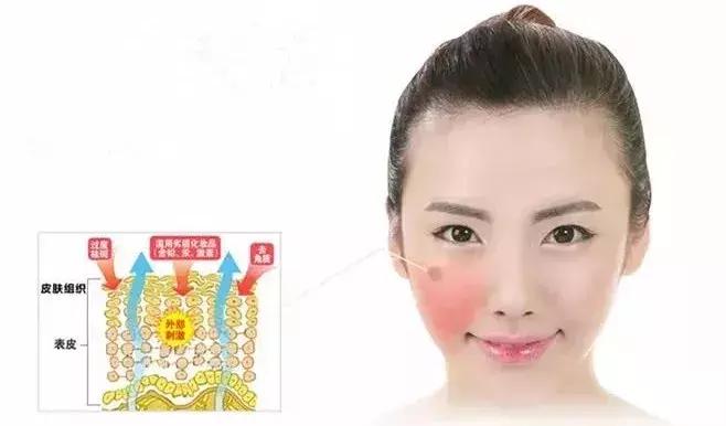 医用敷贴面膜和普通面膜的区别,医用面膜跟普通面膜有什么区别