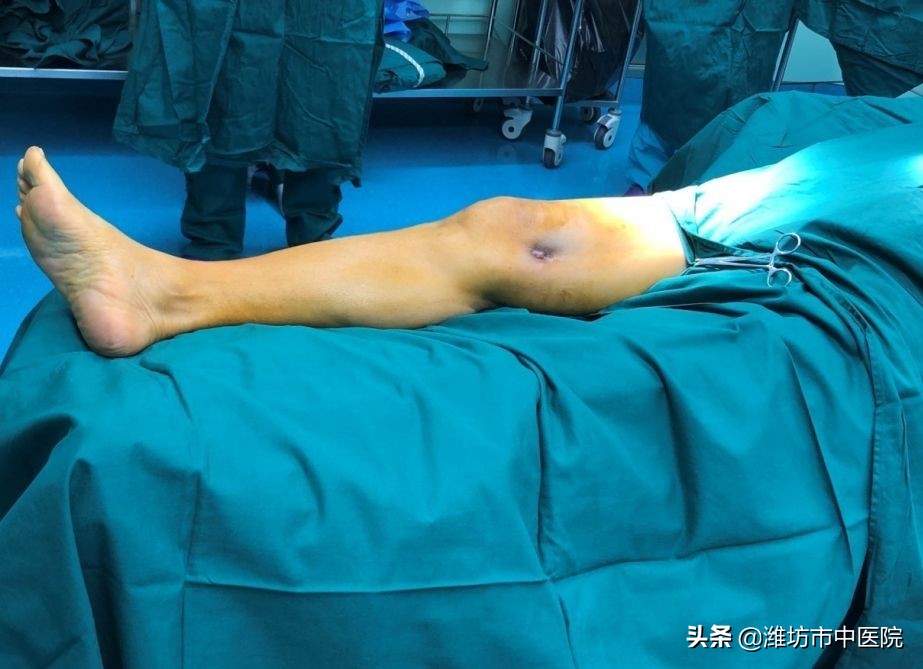 慢性骨髓炎是不是终身无法治愈,慢性骨髓炎持续疼痛吗