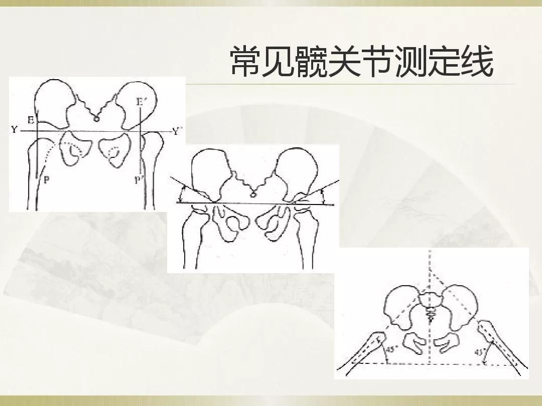骨科x光片读片技巧,放射科骨科读片教程