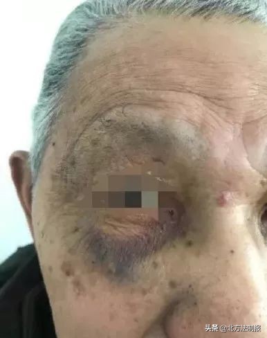 娶了小30岁保姆,八旬老汉娶小30岁保姆遭家暴