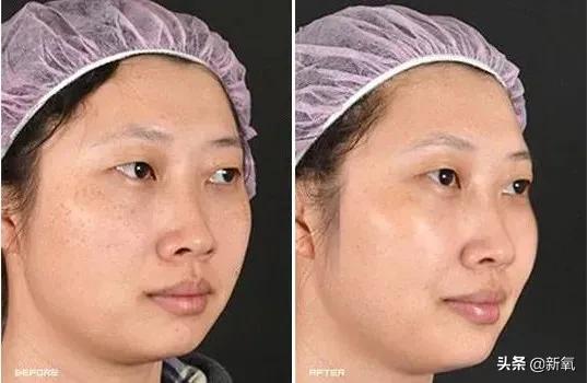 吴昕素颜真的很漂亮吗,吴昕为什么这么频繁上热搜