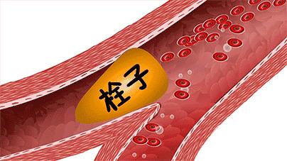 人过了50岁以上为什么精神就不行,人过50岁后脑筋不好是什么原因