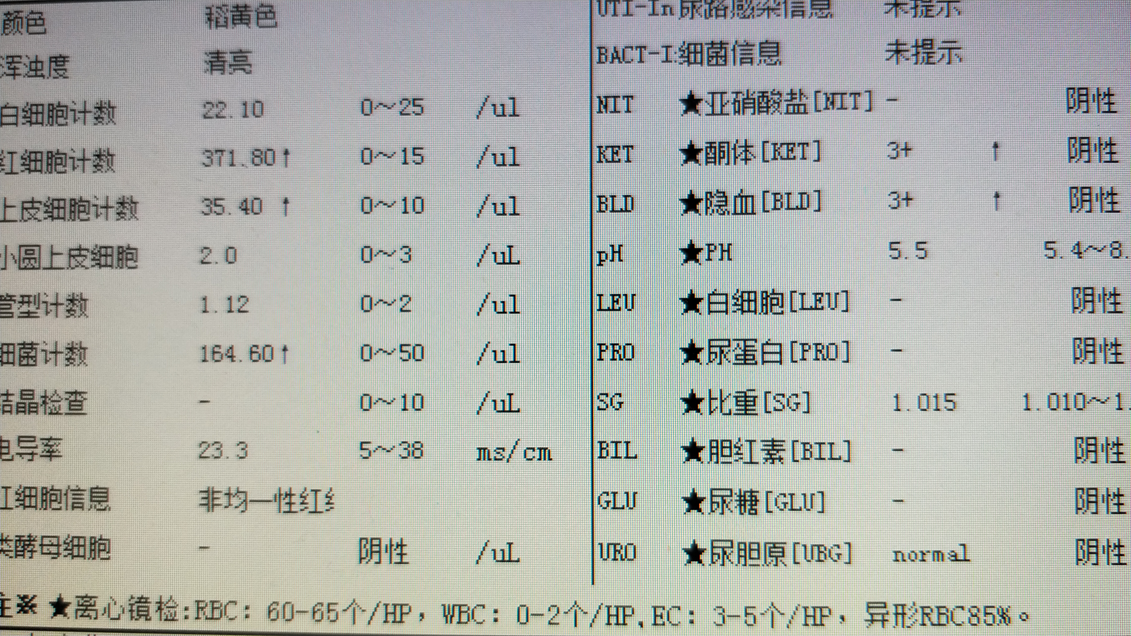 发现尿潜血,发现尿潜血后需要做哪些检查
