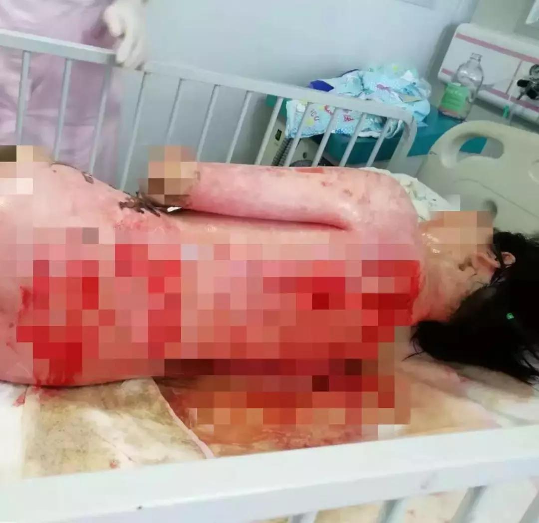 游泳馆内21名小孩发高烧,小孩游泳池游泳后身体反复发烧