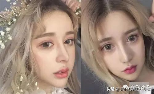 鼻子怎么修复好看呢,鼻型修复方法大全