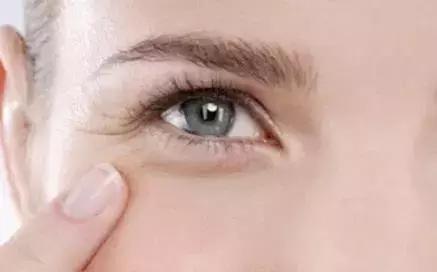 改善眼袋仅980元不开刀让你更出众,消除眼袋细纹大概多少钱