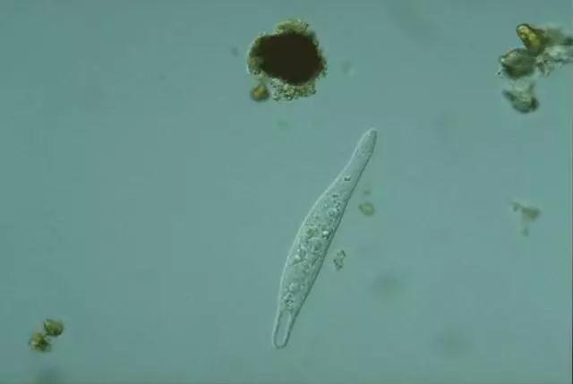 收藏!24种污水处理微生物菌相及指导意义,环保人必看(多图)