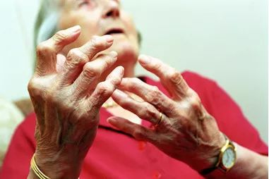 请问医师风湿病有好治方法吗,风湿病自愈的好方法