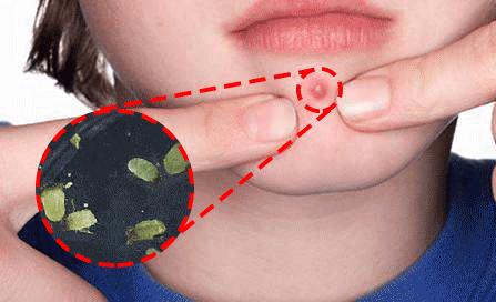 去螨控油皂排行榜,效果超好的去螨虫皂