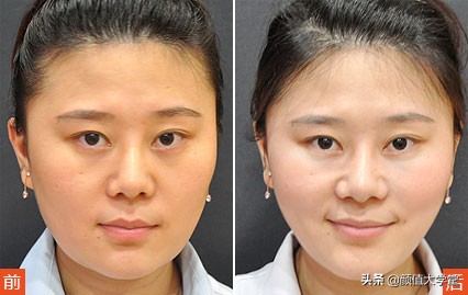 运动可以让脸上皮肤变好吗,脸上敷什么可以让皮肤变好