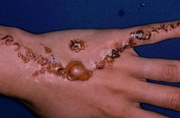 纯植物海娜花染发对身体有伤害吗,海娜花染发有危害吗