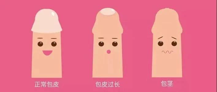 几岁可以做包皮切割手术,包皮切割手术什么年龄最适合