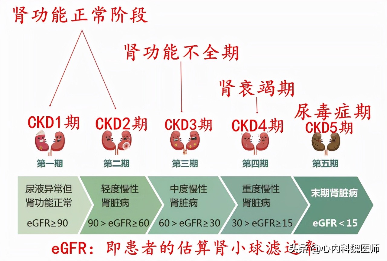 肌酐高要怎么降就知道严重性,肌酐高肾衰竭治愈偏方