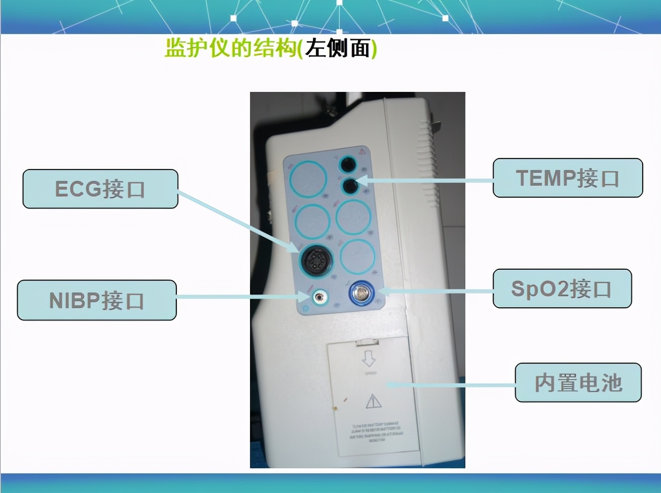 心电监护使用的收费标准,心电监护使用年限