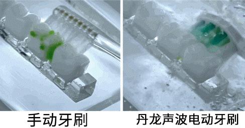 牙齿变黑变黄用什么清洗,牙齿发黄有牙垢用什么牙膏