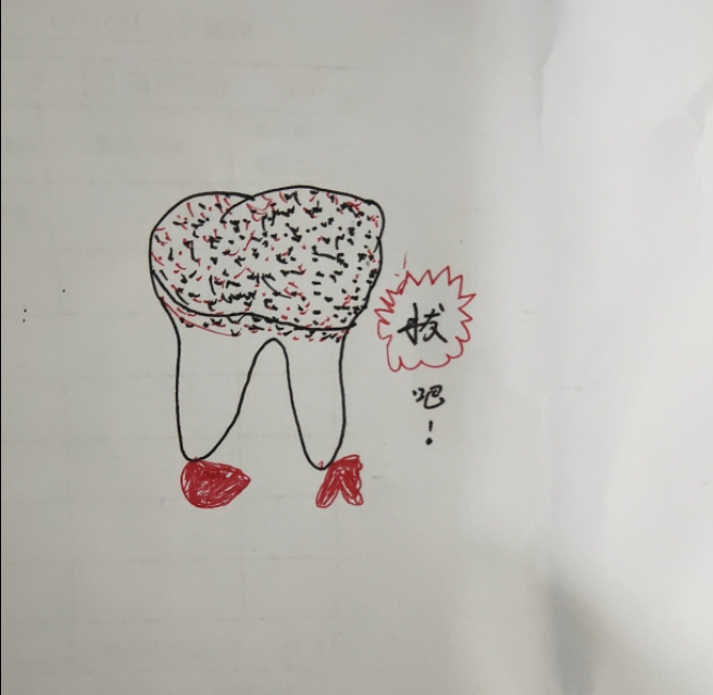 口腔牙齿出了问题怎么办,牙医说牙齿有洞怎么处理