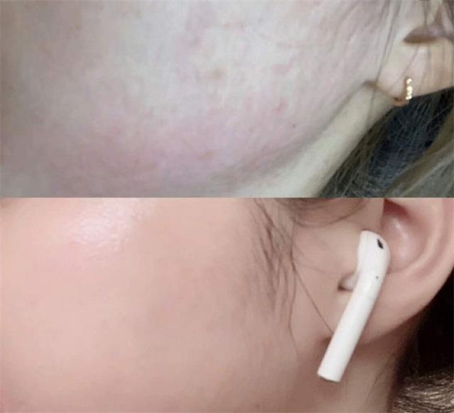 敏感肌不能用什么成分的护肤品,敏感肌不可以用哪些成分的护肤品