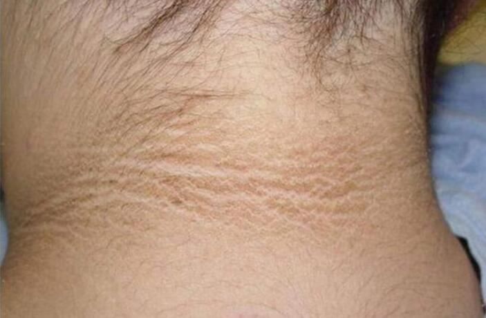 孕妇眼前黑了一下对胎儿有影响吗,怀孕后这些地方越黑说明越健康