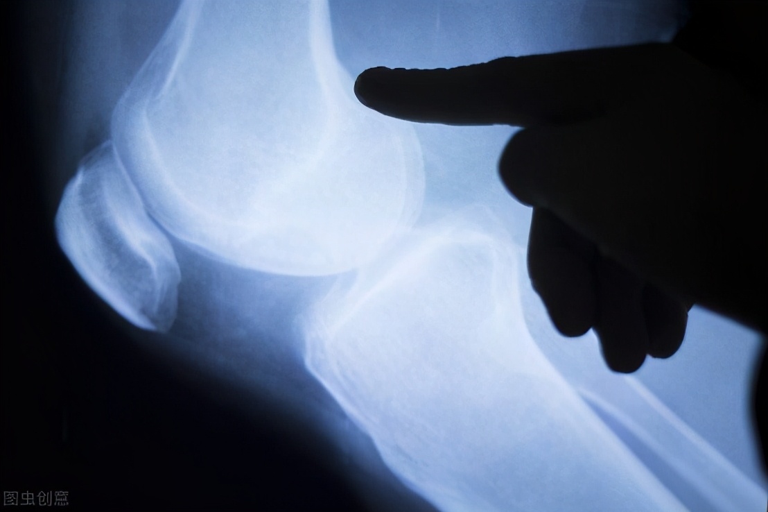 运动伤预防小口诀,如何科学的预防运动伤