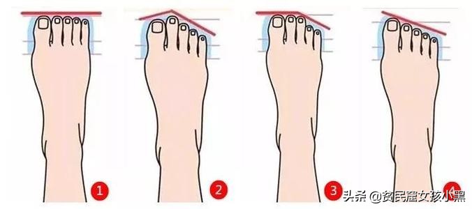 脚胖穿什么高跟凉鞋好看,脚丑穿什么凉鞋好看