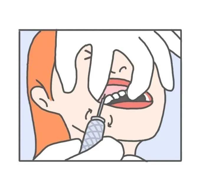 支抗钉和骨钉的区别,13岁矫正牙齿打骨钉亲身经历