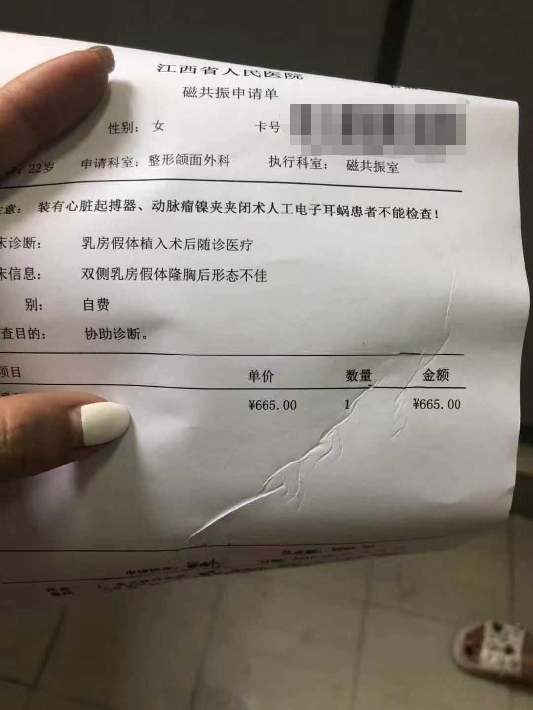 胸部整形整容手术,女子花30万整形结果却是这样的