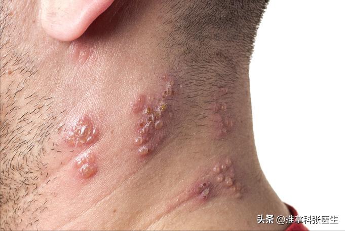 眼睛疼痛睁不开,眼睛疼痛睁不开眼睛怎么回事