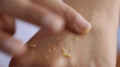 珍珠粉真的可以祛痘吗,珍珠粉祛痘印淡斑效果怎么样