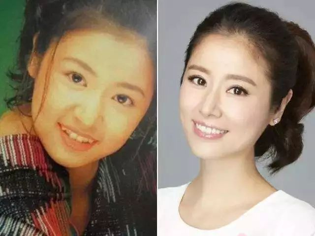 牙虎,虎牙齿拔不掉怎么办