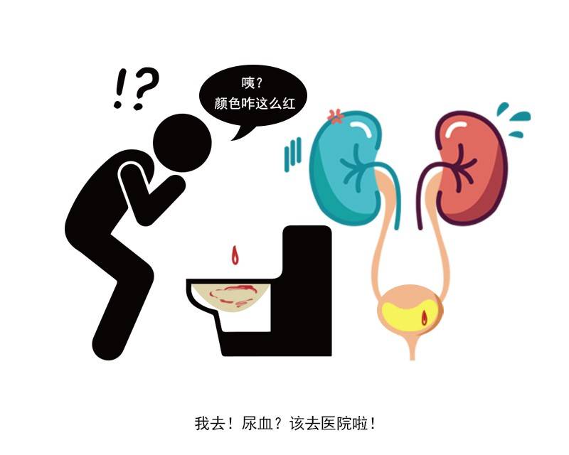 排尿有5个变化及时查肾不能拖,排尿有这3种情况可能是癌