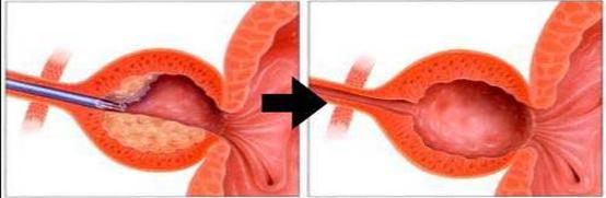 山东治疗泌尿外科比较好的医院,山东大学附属医院泌尿外科专家