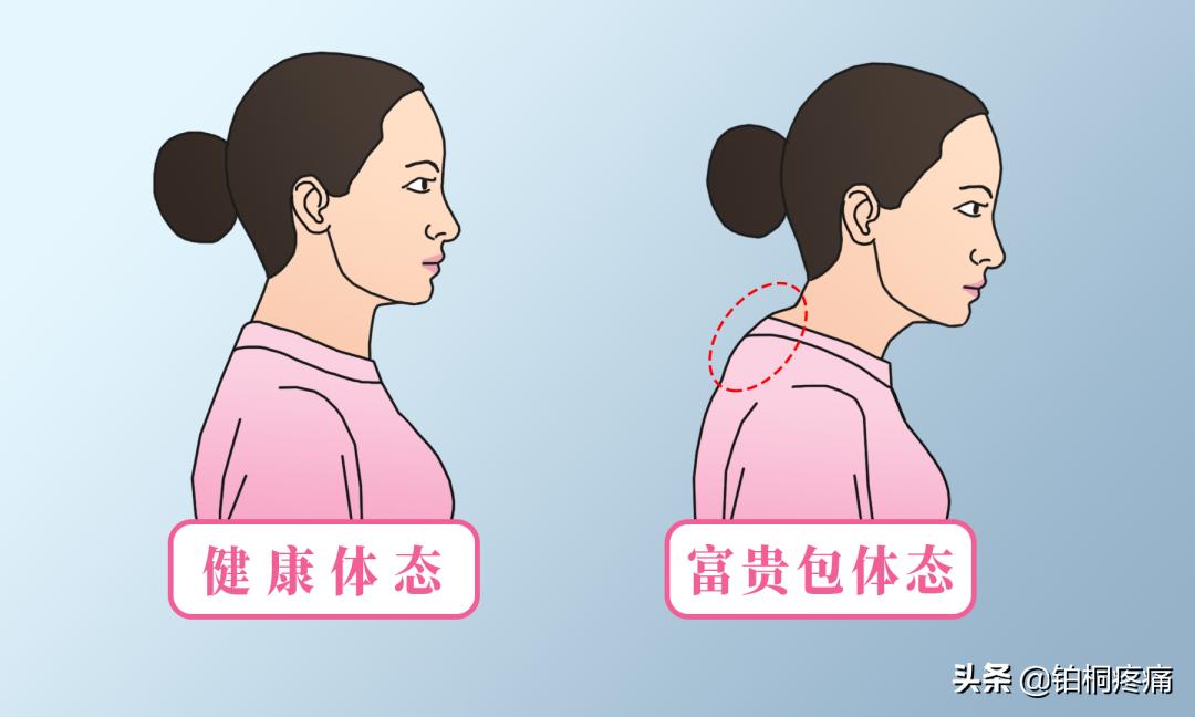 富贵包夺命包真的是这样吗,富贵包夺命包怎么治