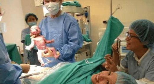 剖腹产最尴尬的事是什么,剖腹产手术最尴尬的事