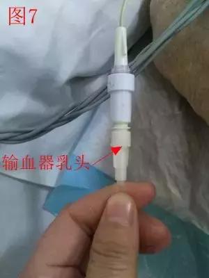 输血的这些错误操作，你有吗？