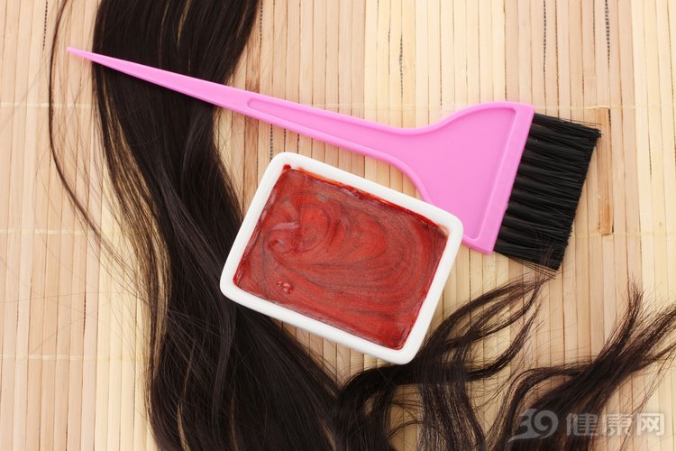 女子染发后患上银屑病,女子染发致头皮感染患病