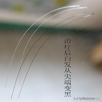 着凉打喷嚏流鼻涕鼻塞怎么处理,一受凉就鼻塞打喷嚏流鼻涕怎么办