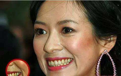 皮肤有点黄的女生会有男生喜欢吗,女生皮肤偏黄男生会喜欢么