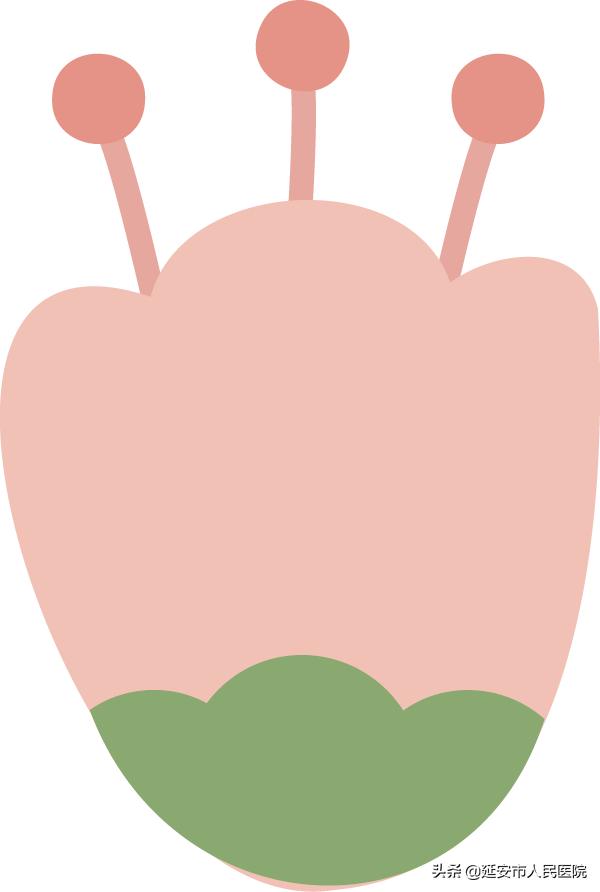 慧眼识“癌”丨中国医科大学张进教授成功诊治两例隐匿性输卵管癌