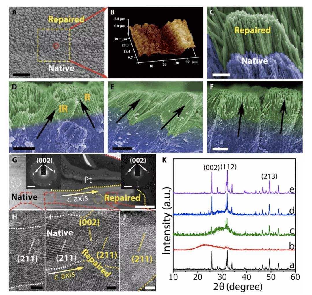 浙江大学牙釉质修复最新,浙江大学牙齿再生术
