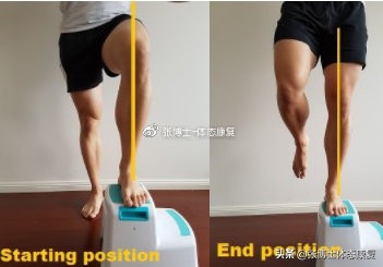 体态矫正小腿外翻,成年人x型腿加膝外翻怎么办