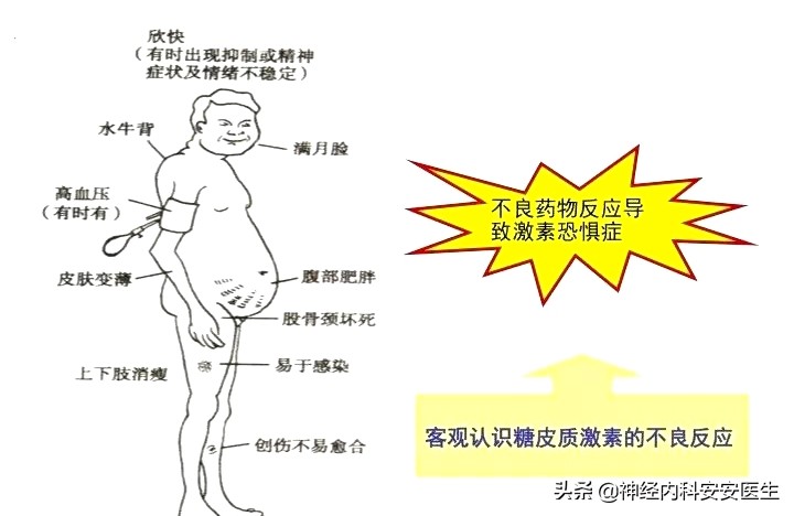 为什么人们谈激素色变,皮肤科谈激素色变