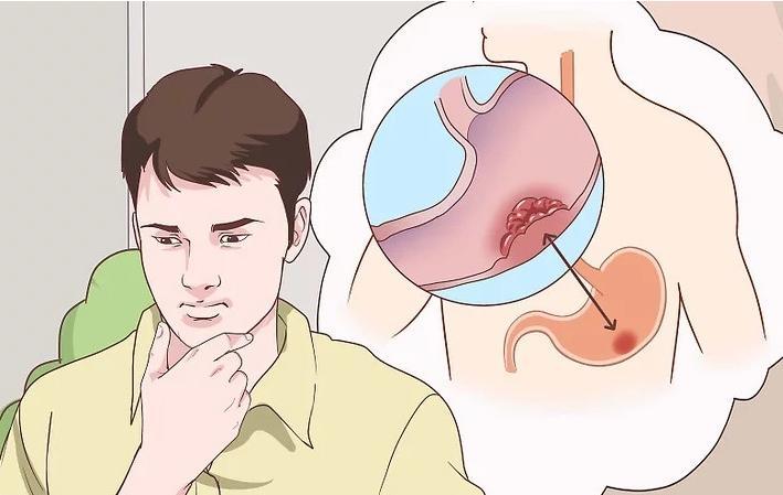 胃癌术后头晕恶心怎么回事,胃癌术后反胃呕吐怎么办