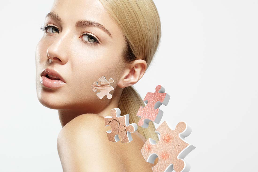 痘痘严重爆发，口服抗生素治疗安全有效吗？