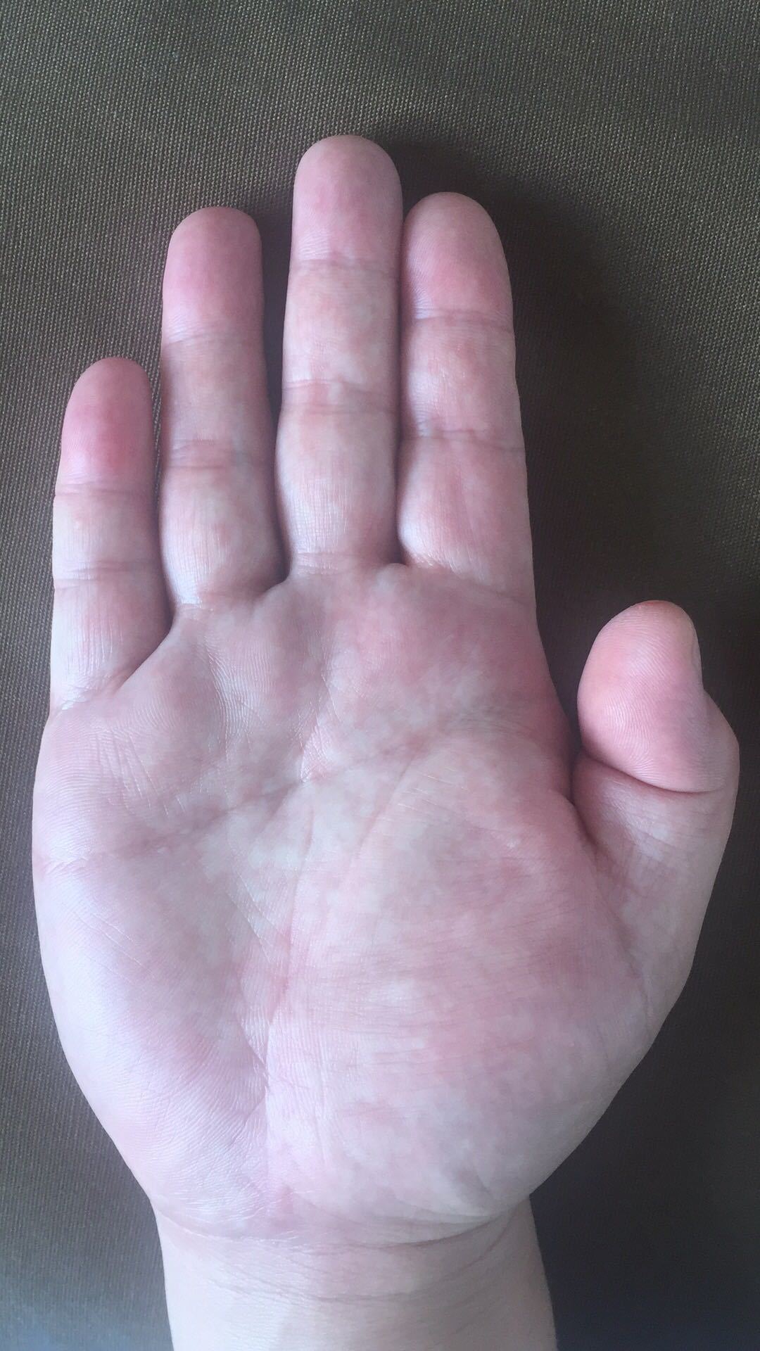 左手手指酸麻胀痛是什么病的前兆,手掌和手指酸麻疼痛是怎么回事