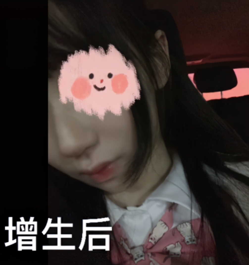 千万网红整容,女子整容失败变巫婆鼻