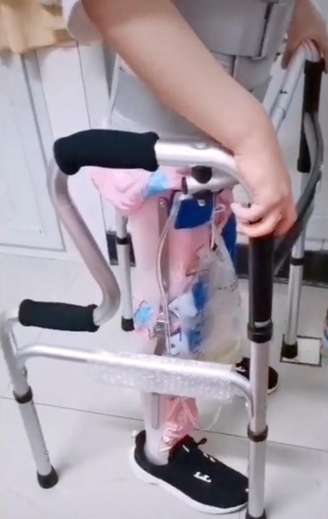 小孩学舞蹈瘫痪的案例,5岁女孩练舞蹈导致瘫痪