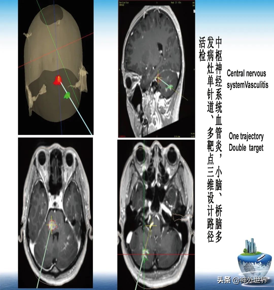 宣武医院神经外科王亚明祖籍,北京宣武医院神经科专家王亚明
