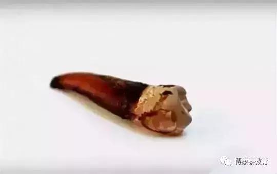 博康泰丨青岛9岁儿童喝可乐，牙齿酥到用镊子一捏就碎