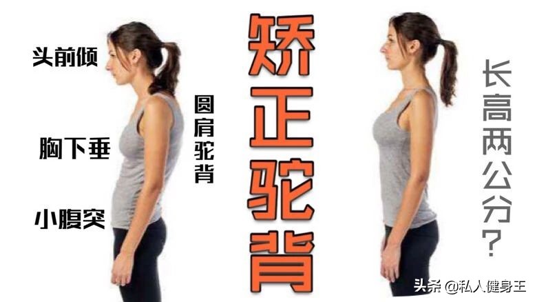 驼背很严重如何矫正,40年驼背站墙根纠正驼背可以吗