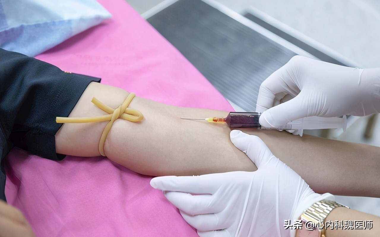 他汀的副作用肌痛怎么办,服用他汀导致的肌肉疼痛怎么缓解